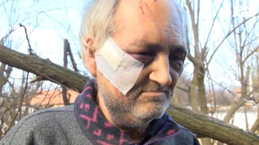 Битият дядо от село Ресен: Единият ме заплаши с убийство