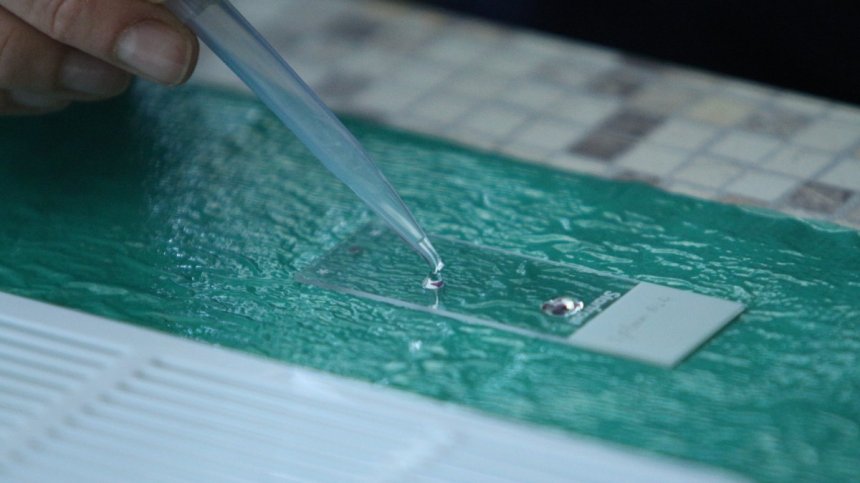 Изкуствен интелект диагностицира Ковид-19 с 90% точност