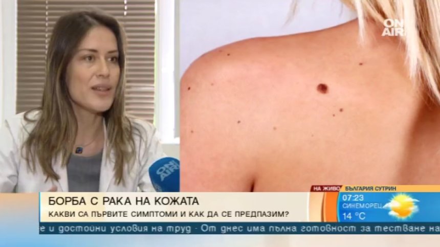 "Евромеланома 2019": Дерматолози преглеждат безплатно за рак на кожата