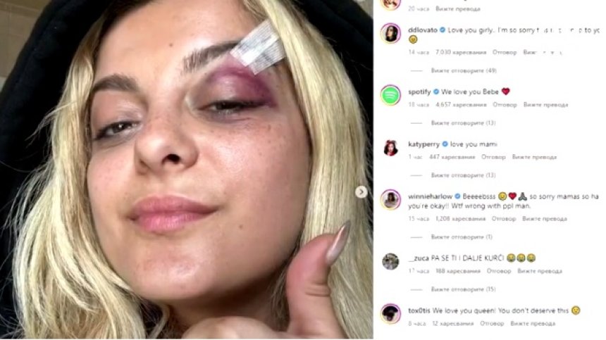 Фен цапардоса Биби Рекса с телефон и цепна веждата ѝ