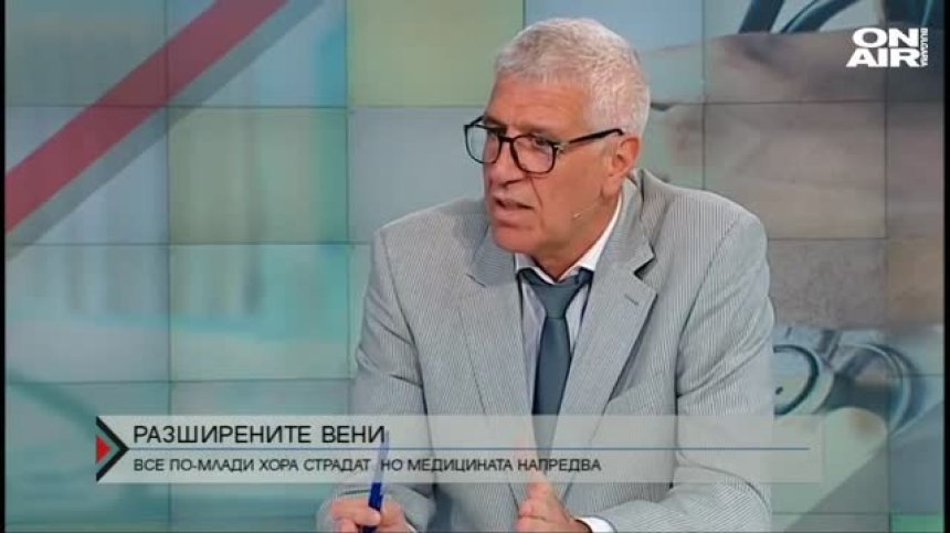 41% от българите страдат от разширени вени