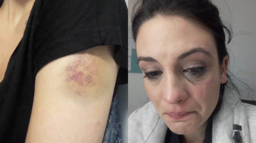 Диана Димитрова: Претърпях брутално насилие и няма да мълча