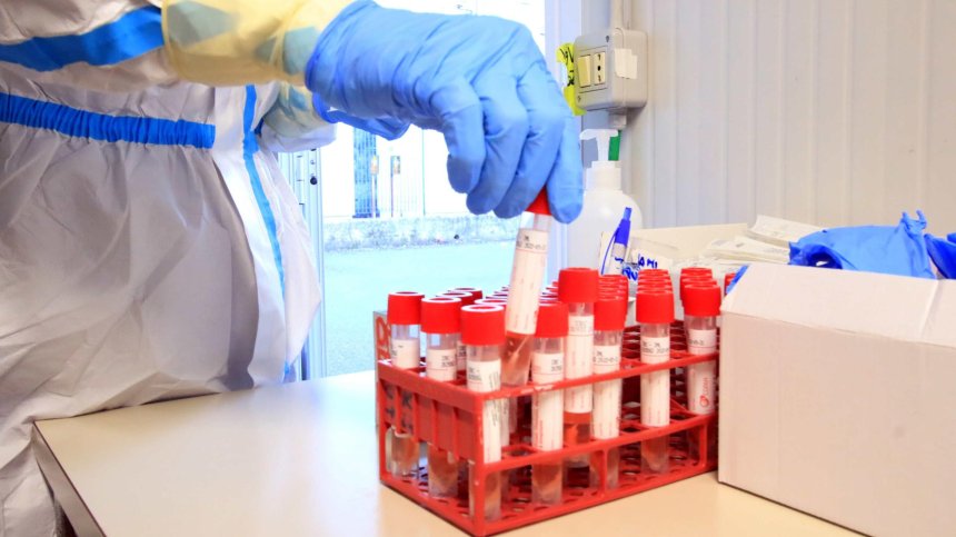 Изследване: Ковид-19 може сериозно да увреди панкреаса