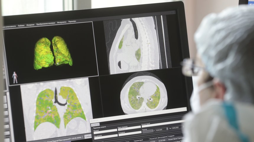 Имунолог каза колко трае имунитетът след преболедуване и ваксиниране