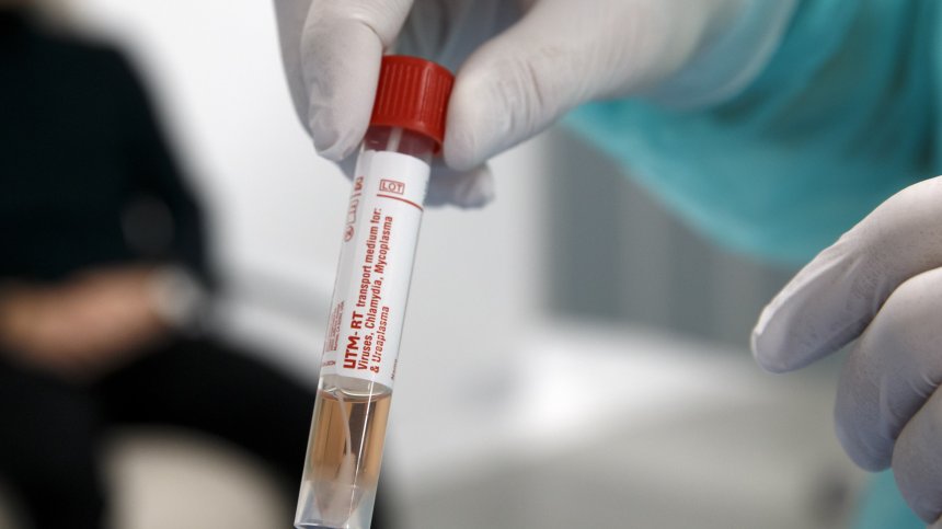 Руски вирусолог за опасните съвети, които няма да ни защитят от Ковид-19