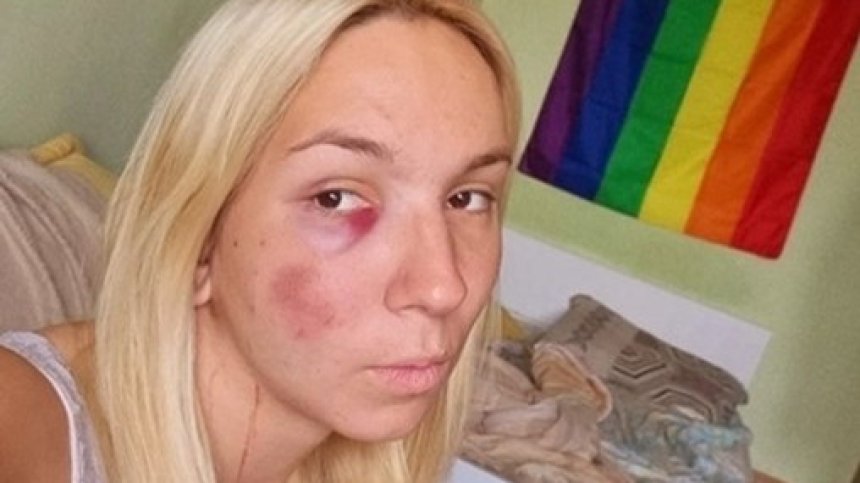 Емили след челния удар с бус: Карах по велоалеята, спазвам закона