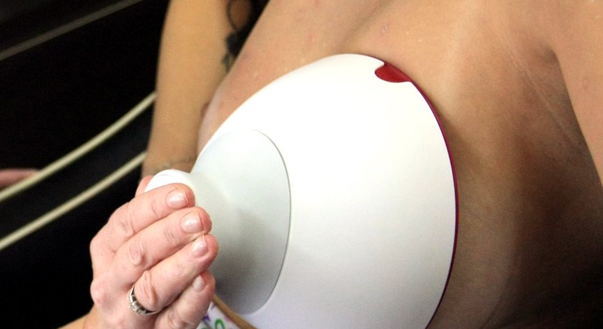 3500 жени годишно се разболяват от рак на гърдата у нас