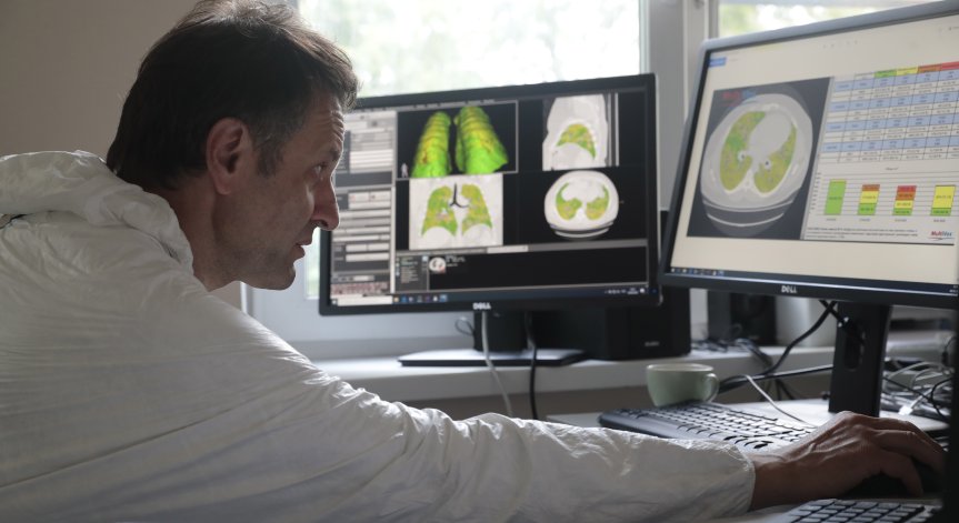 Невролози: Дори леки симптоми на Ковид-19 могат да увредят мозъка