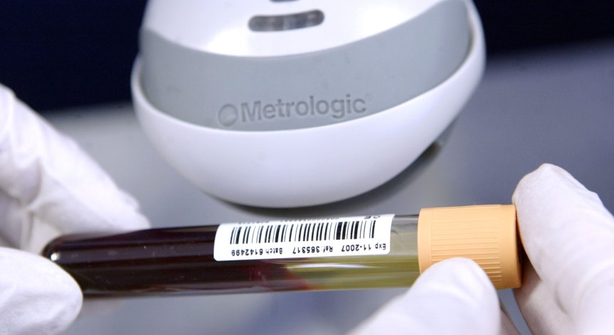 Деменцията увеличава риска от фатален край след Ковид-19