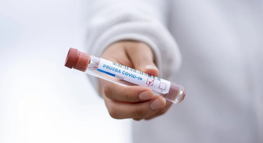 Направление за PCR ще се издава и след положителен бърз антигенен тест