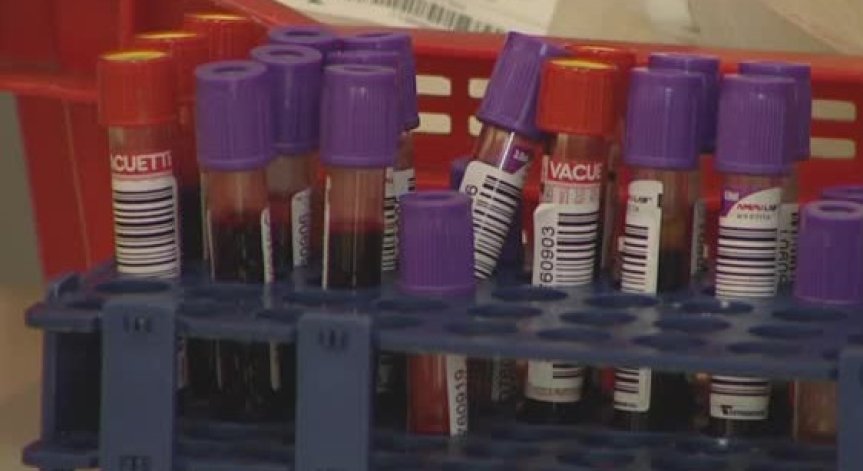 Обрат в лечението на Ковид-19, СЗО не препоръчва кръвната плазма