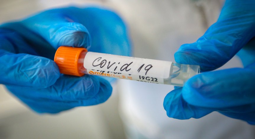 Ковид картината: 7 нови случая за ден, 140 са пациентите в болница