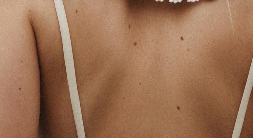 Защитавайте кожата си.