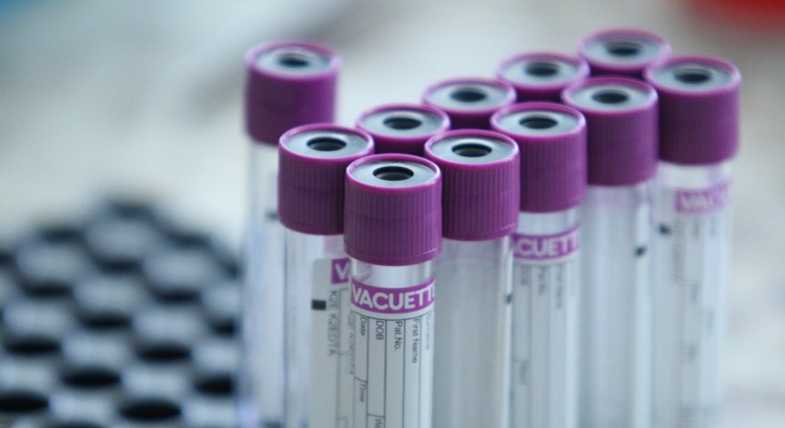 СЗО ще изпрати много нови тестове за Ковид-19 на по-бедните страни