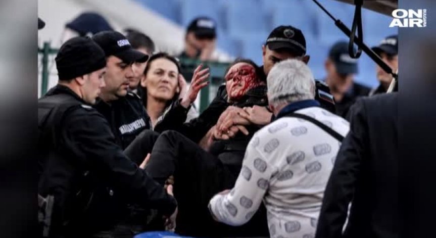 Колега на ранената полицайка - готов да пази следващото дерби