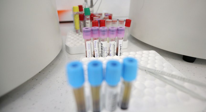 Двама души са починали с Ковид-19 за ден, 67 са новоустановените заразени