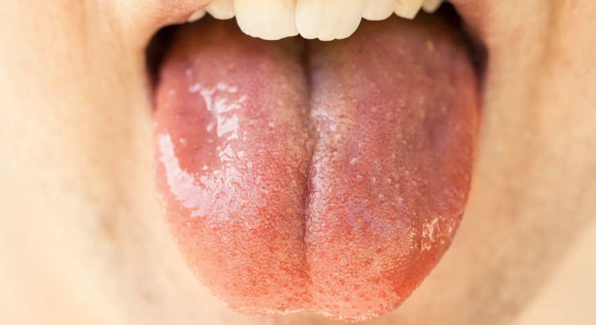 За какво сигнализира повишеното количество слюнка в устата