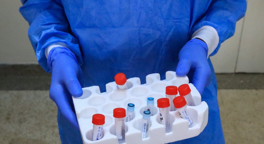 Здравното министерство не одобри идеята за PCR тест при хоспитализация