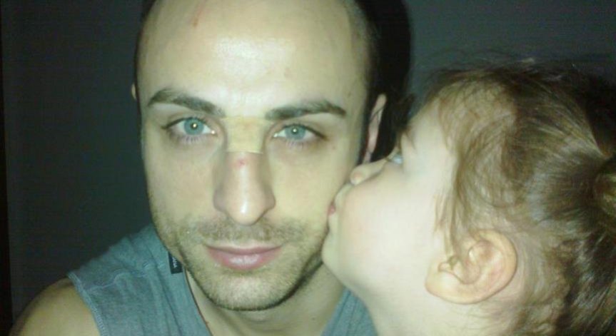 Голямата щерка изцерява одраскан нос на Бербатов