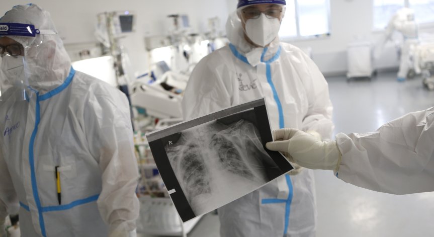 2/3 от тежко преболедувалите Ковид-19 страдат от оплаквания 6 месеца по-късно