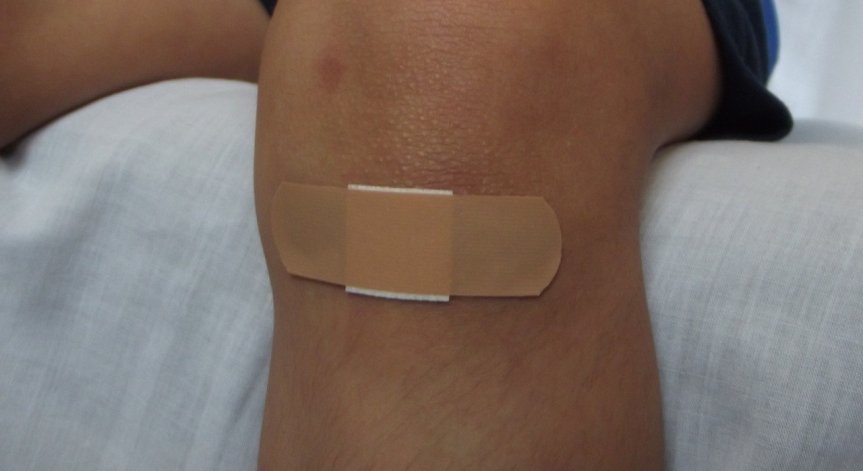 Как да третираме детските рани при охлузване?