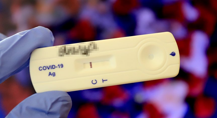 ПКК, рентгенова снимка и ехокардиография задължително след Ковид-19