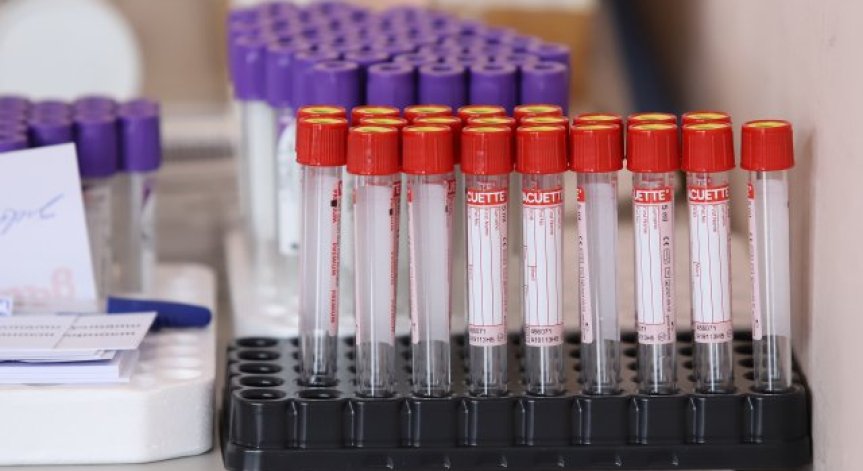 БЛС няма да приеме лимити за направления за PCR тестовете