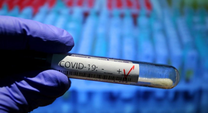 Личните лекари вече могат да назначават PCR тестове