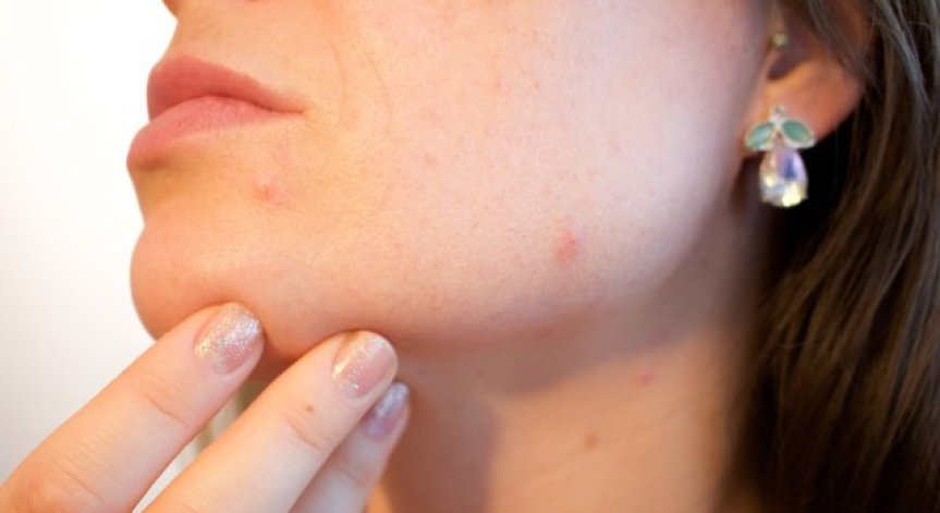 Въоръжете се с кремове, серуми и етерични масла за здрава кожа през есента