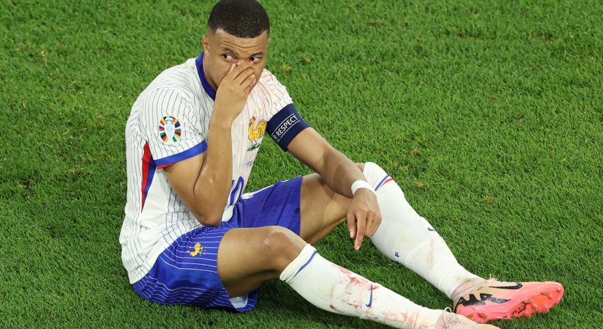 Няма да оперират счупения нос на Мбапе, ще играе с маска