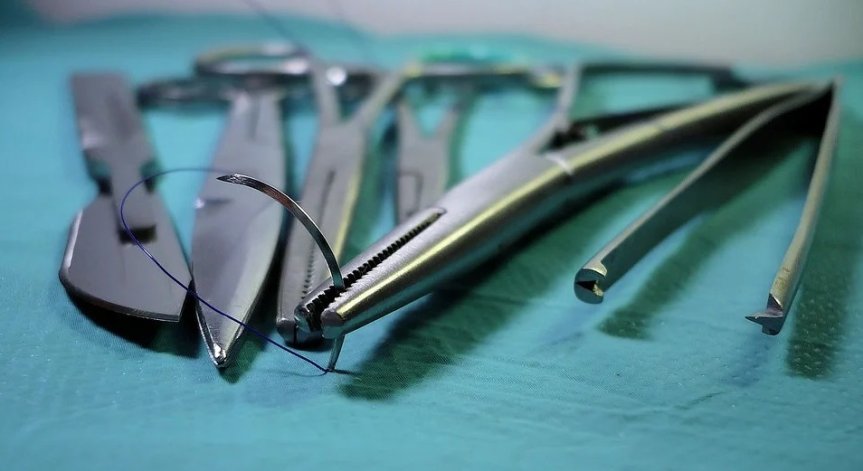 Хирурзи от МБАЛ-Пазарджик отстраниха тумор, който тежи близо 5 кг