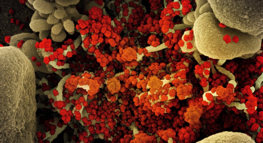 СЗО: Засега коронавирусът няма мутация, която да го прави по-силен