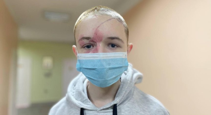 9 дни в кома с разцепен череп: Украинче оцелява по чудо след руска атака