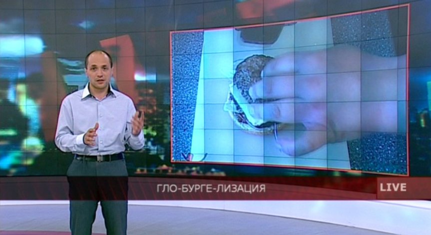 Гло-Бурге-Лизация