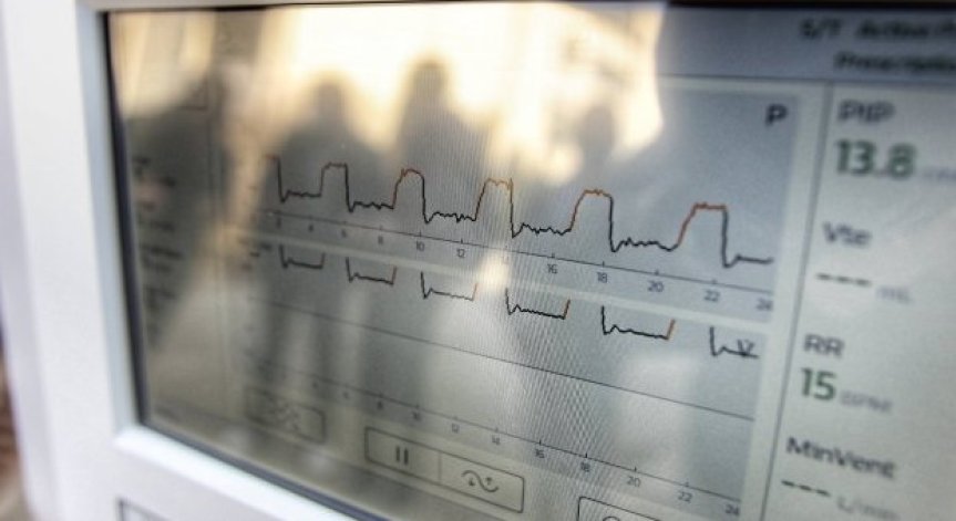 МЗ дава 30 млн. лв. за допълнителна медицинска апаратура за Ковид-зоните