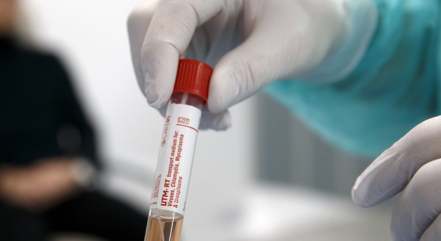 Започна вторият етап на изпитвания на ваксина срещу Ковид-19 в Русия