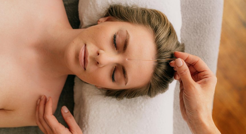 Лечението с акупунктура намалява симптомите на сезонните алергии