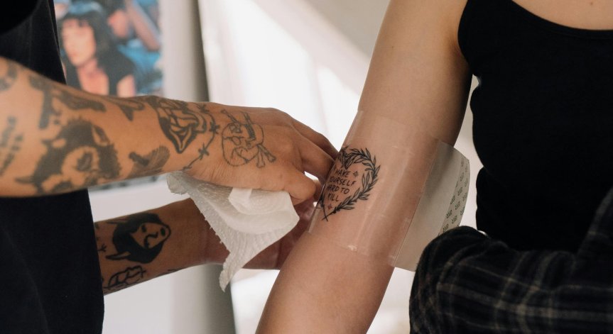 Какви са страничните ефекти от лазерното премахване на татуировки