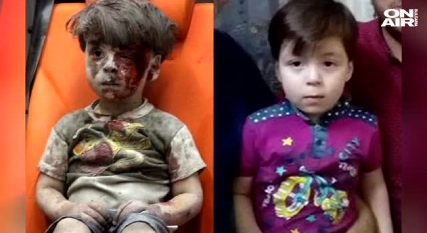 Детето, което стана лицето на войната в Сирия, използвано срещу Асад