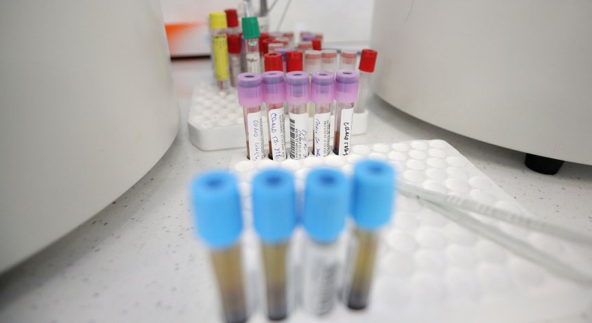 Спад на новозаразените, 3000 са излекувани, 70 души са починали