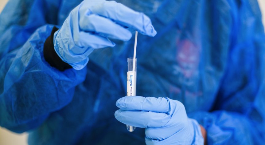 Обнародват промените за електронните направления за PCR тест