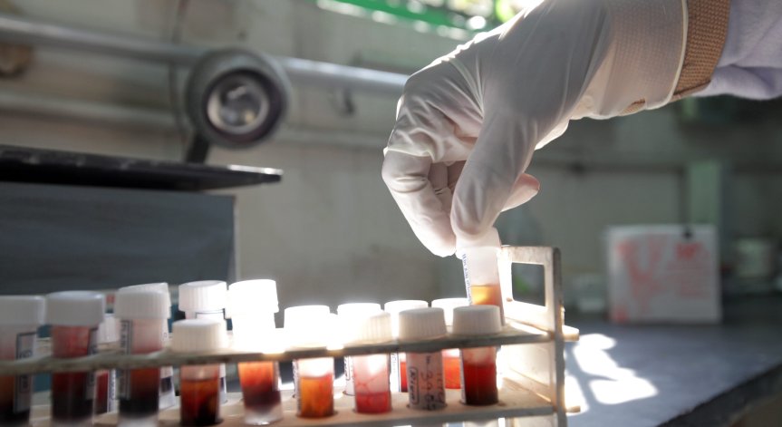 Учени откриха потенциално лекарство срещу ХИВ