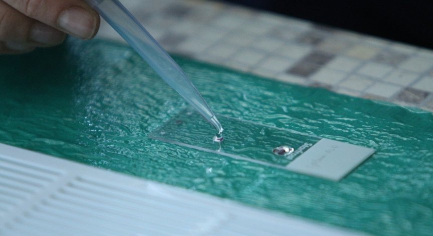 Изкуствен интелект диагностицира Ковид-19 с 90% точност