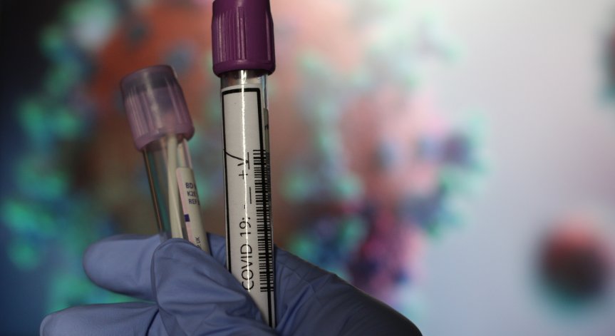 10-дневната карантина на влизащи у нас се отменя след отрицателен PCR до 24 ч.