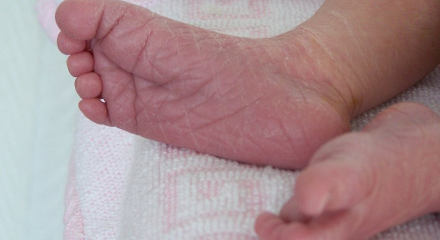 Признаците на сухата кожа и как да се справим с проблема