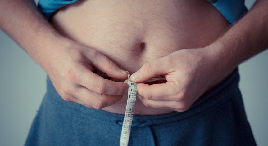 Затлъстяването води до оплешивяване