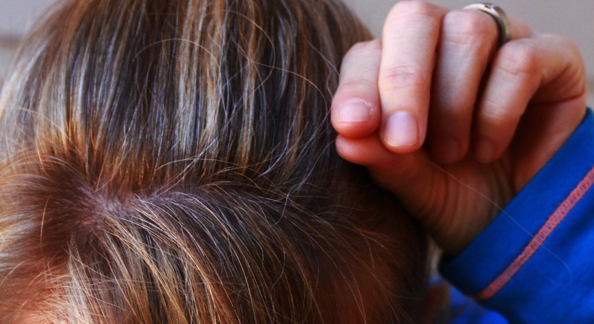 Тайната на побелялата коса: Стрес, тютюнопушене и липса на В12