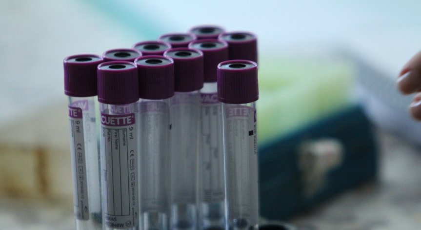 Прокуратурата се самосезира заради бум на Ковид-19 в Джурково