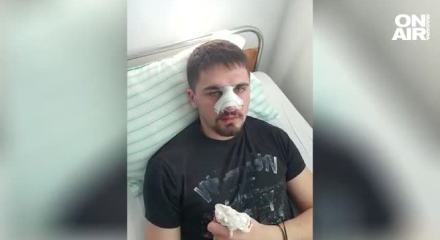 Цивилни полицаи пребили жестоко 19-годишно момче в Плевен?