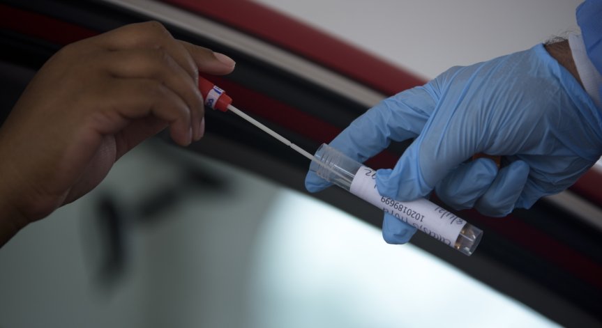 Производителите на тестове за Ковид-19 са сред печелившите в пандемията